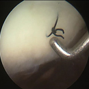 Bio-orthopaedics between innovation and health policies