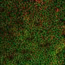 photo by California Institute for Regenerative Medicine from Flickr